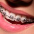 Dental Diamonds Studio – o clinica stomatologica Bucuresti cu renume